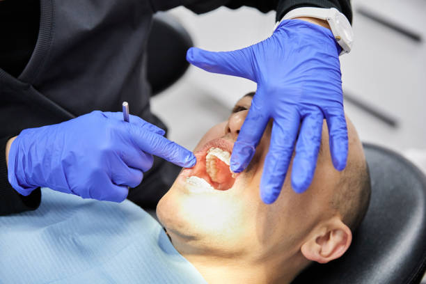 Best Emergency Dental Care for Broken or Chipped Teeth in Georgetown, CO